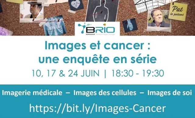 BRIO_images et cancer
